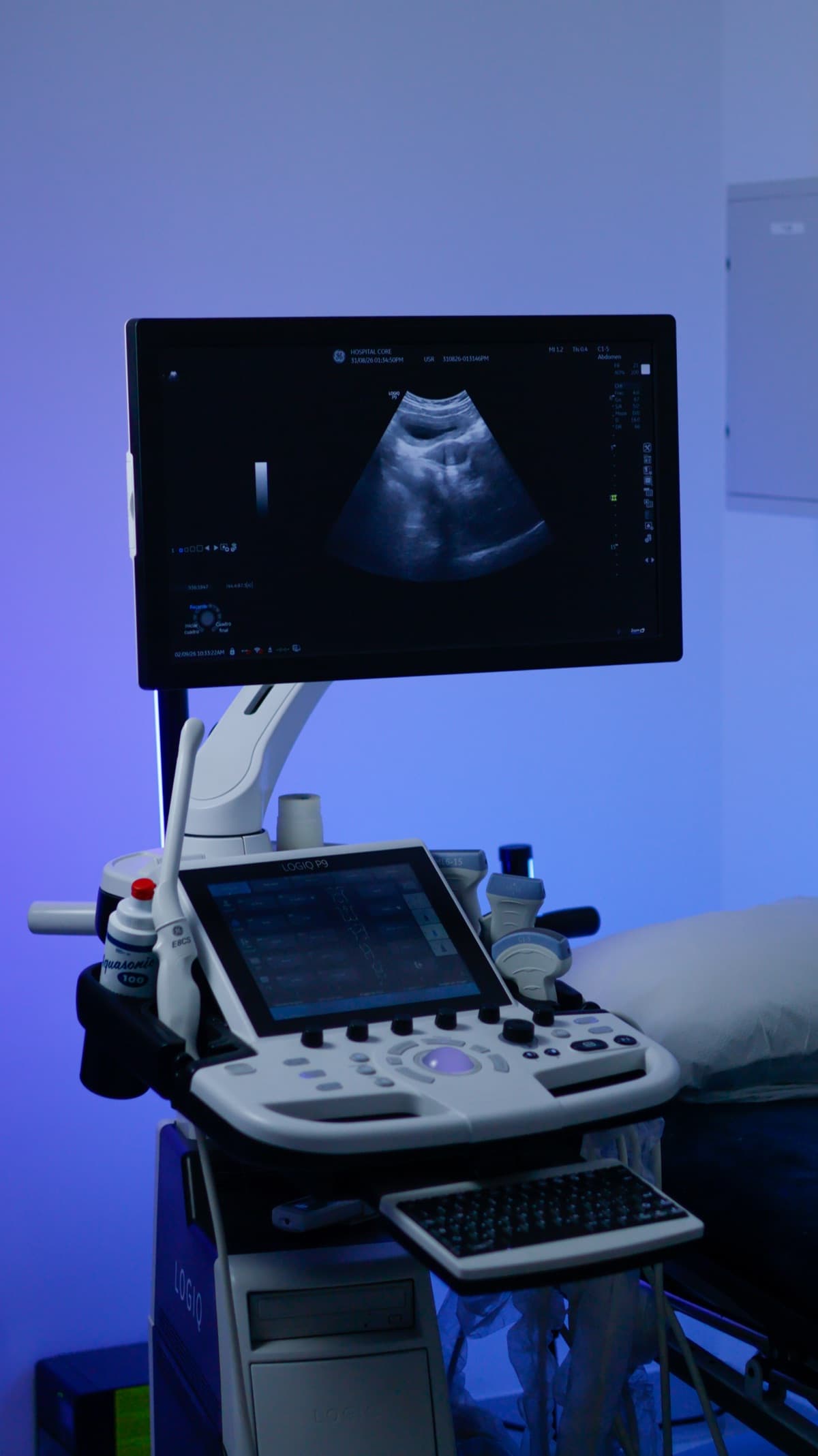 Equipo de ultrasonido con su consola y un monitor superior que muestra una imagen del estudio, junto a una camilla